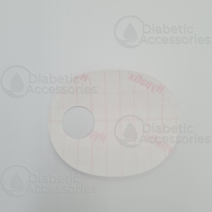 TruSteel Infusion Set Overlay Plaster